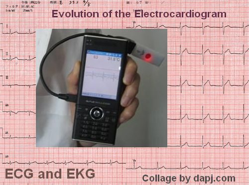 ECG EEG EMG bio-amplifier